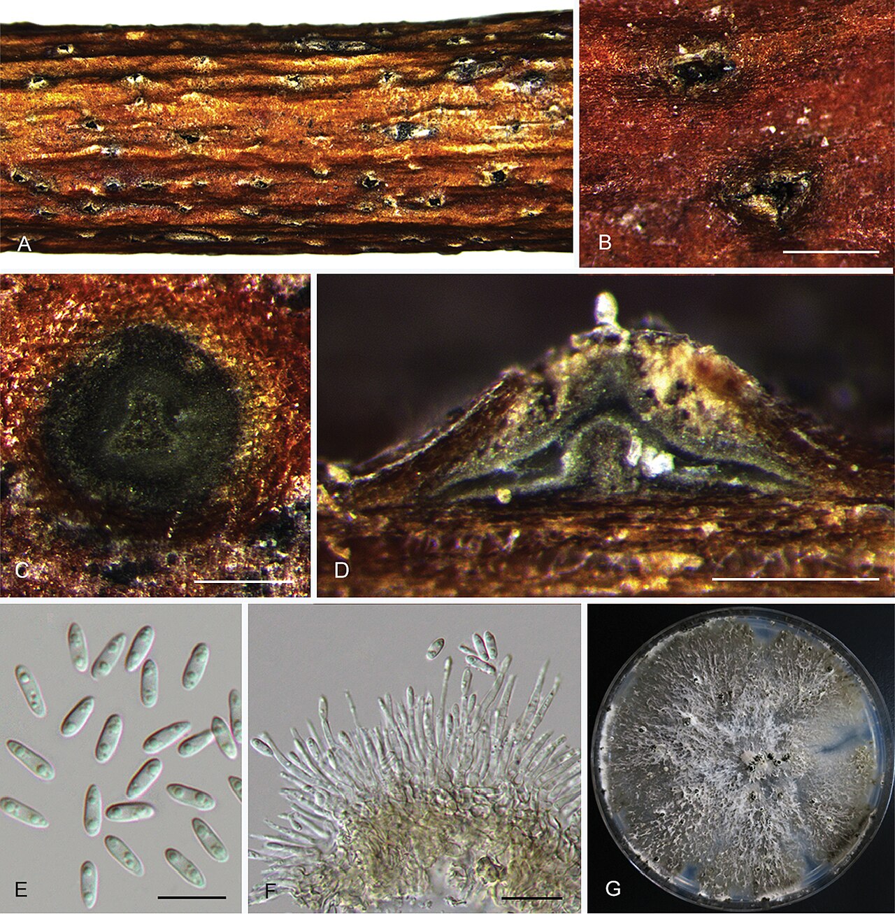 Diaporthe eres (anamorph Phomopsis) — microscopic view of fruiting bodies and spores of a fungus from the branch canker complex