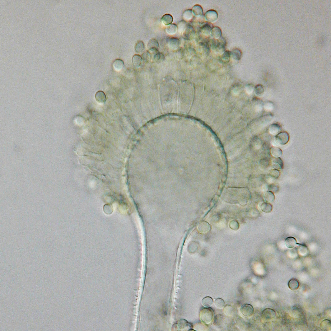 Aspergillus flavus mold conidiophore under a microscope, the cause of aflatoxins during poor drying