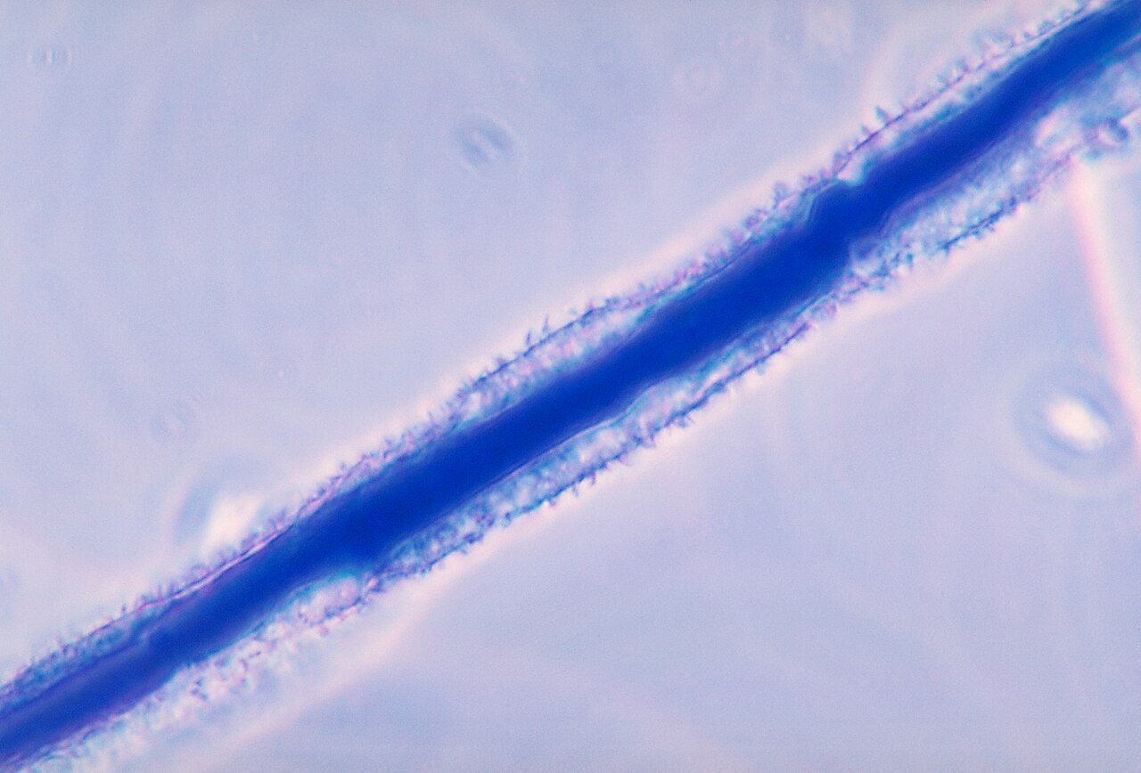 Aspergillus flavus mold, producer of aflatoxins