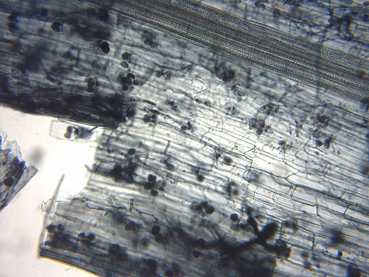 Arbuscular mycorrhiza in root under microscope — symbiosis of fungi and plant